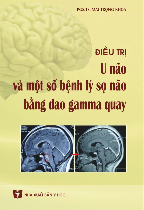 Sách Điều trị U não và một số bệnh lý sọ não bằng dao gamma quay